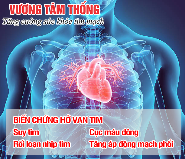 Hở van tim gây ra nhiều biến chứng nguy hiểm.jpg